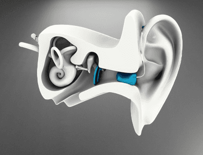 Close-up of a human ear with a hearing aid partially visible inside the ear canal.