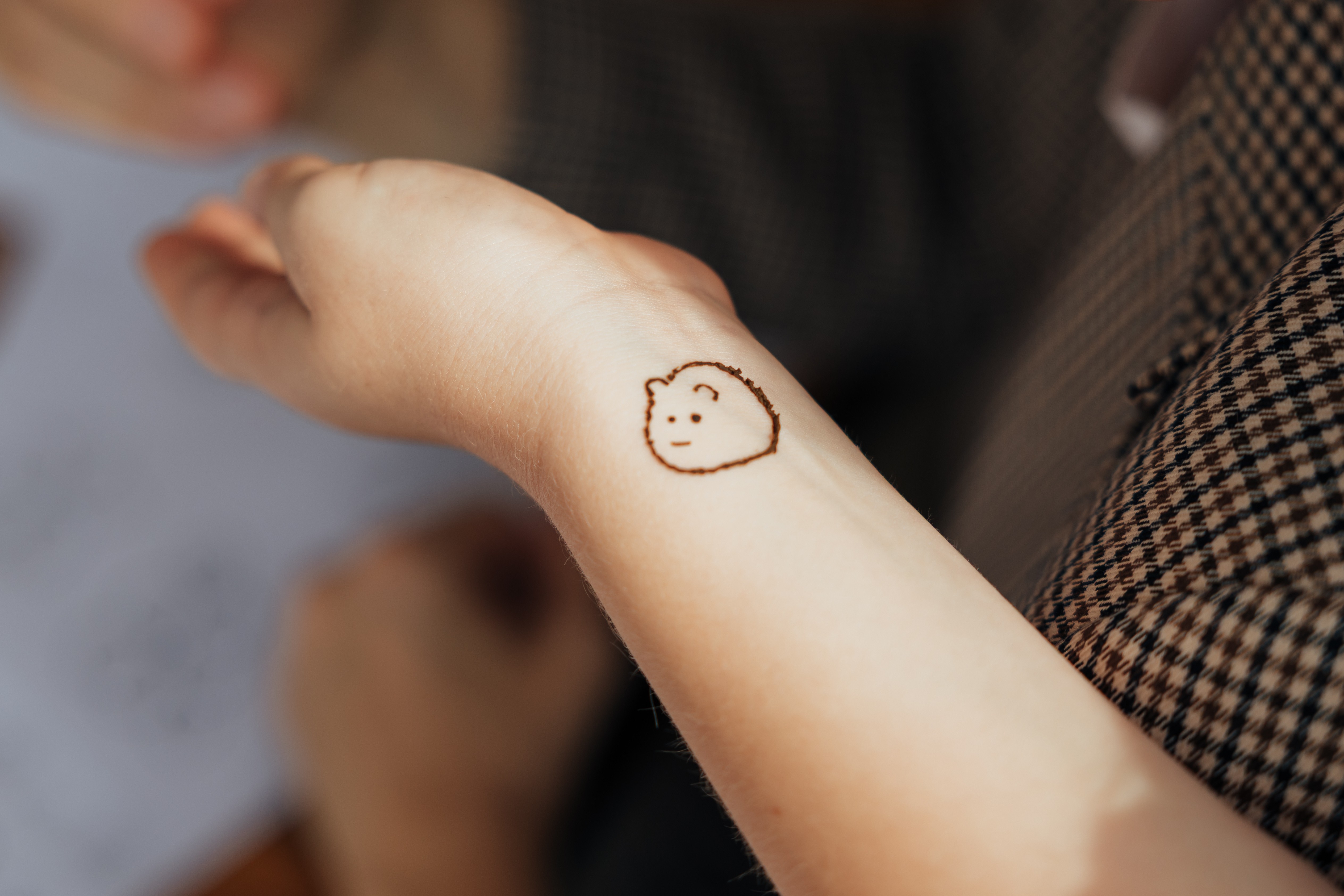 Tattoo Removal for Wrist and Forearm