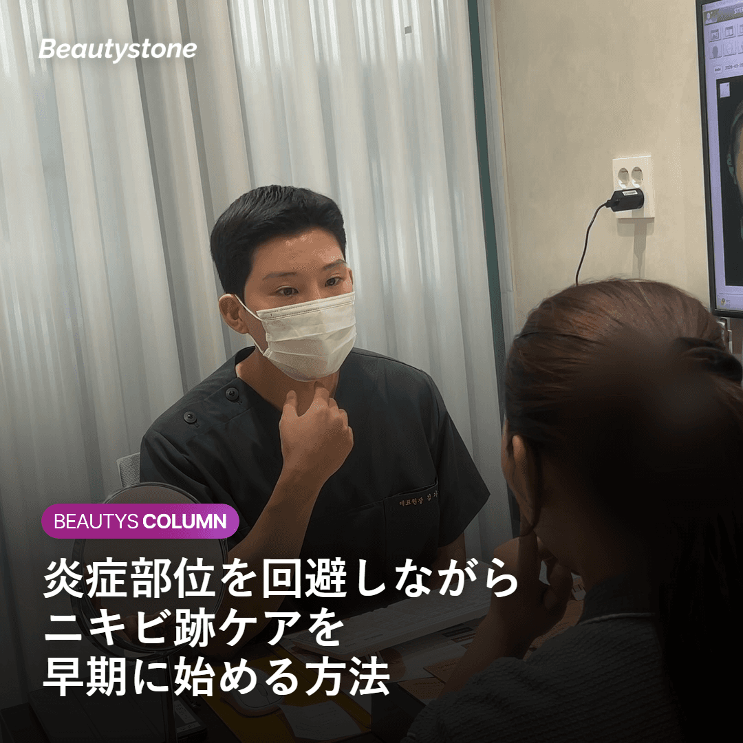炎症部位を回避しながらニキビ跡に施術を行う病変マッピングのイメージ