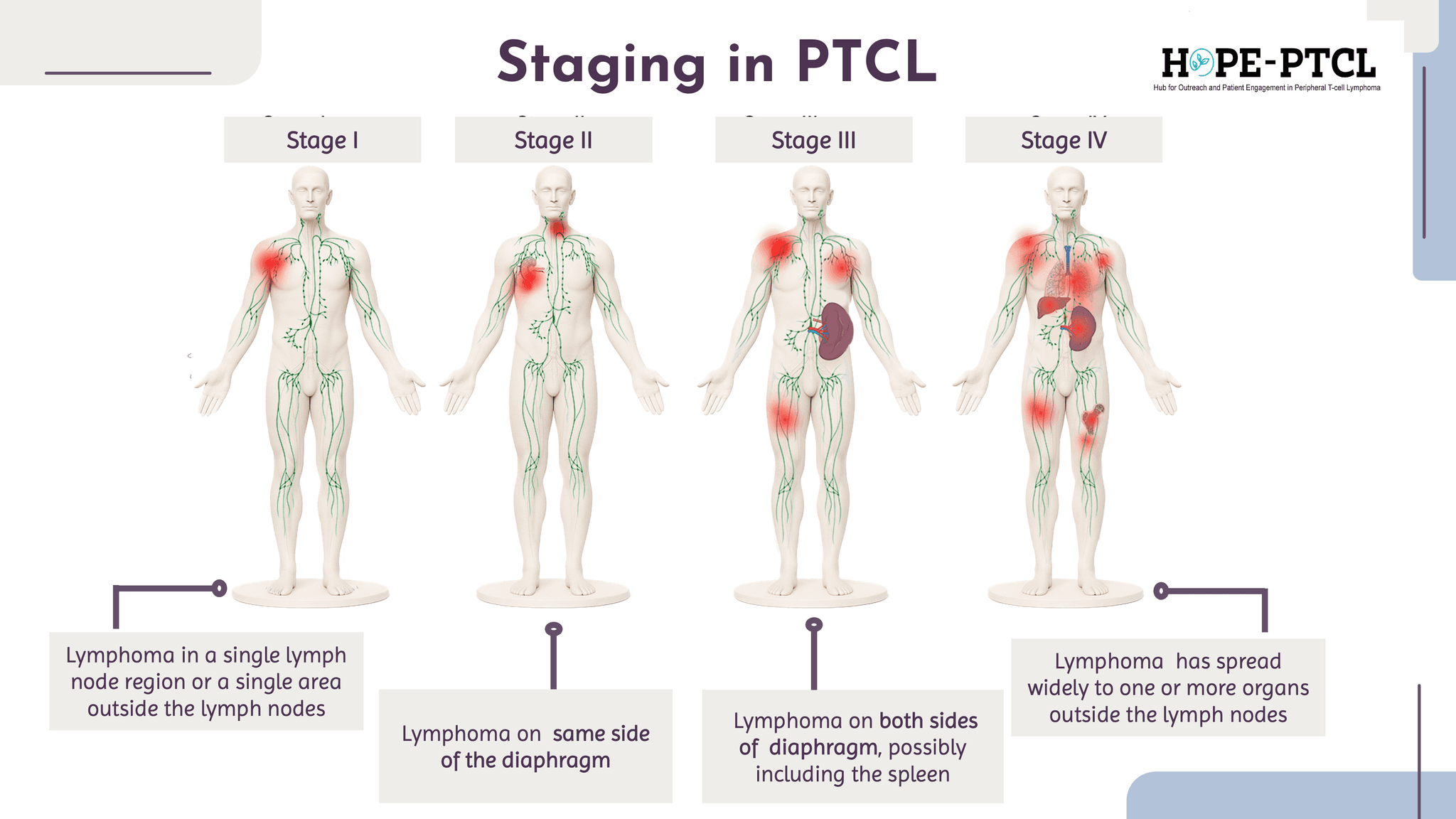 What Is PTCL