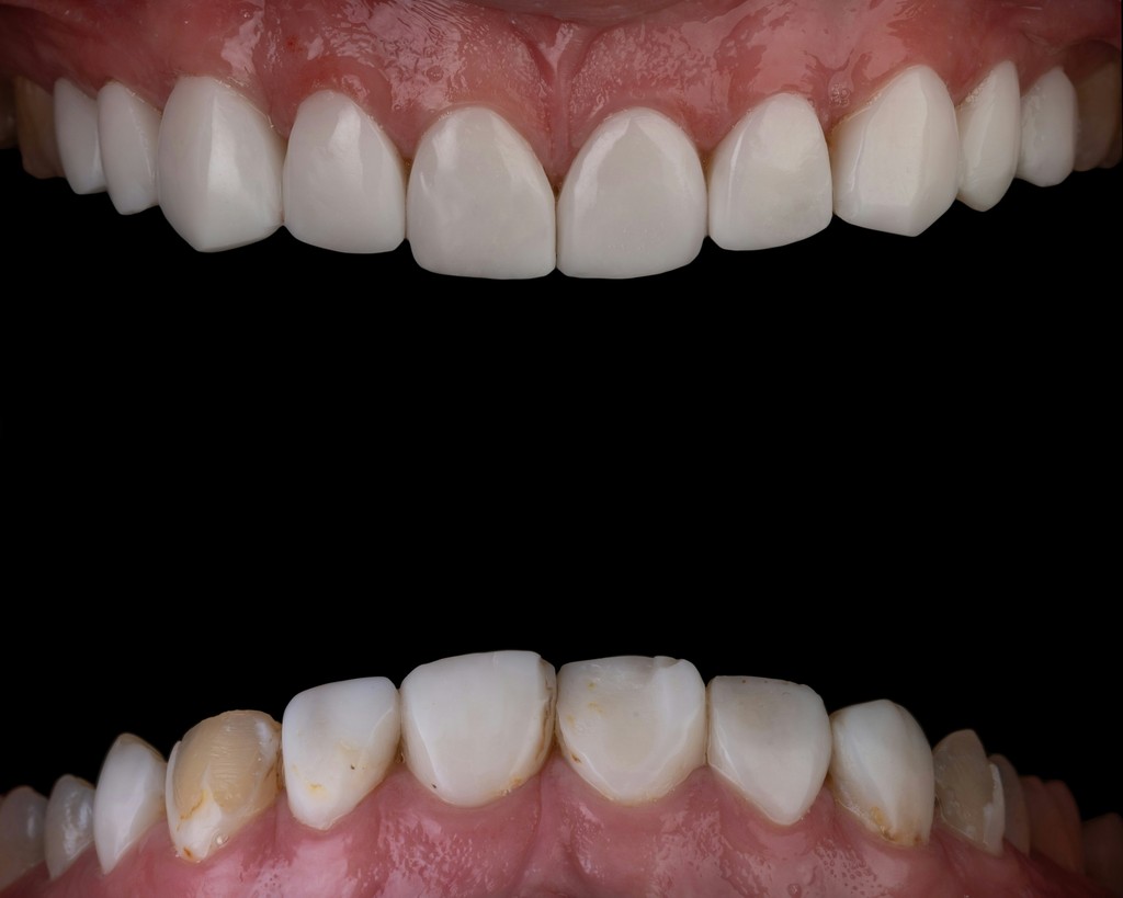 Dental Issues