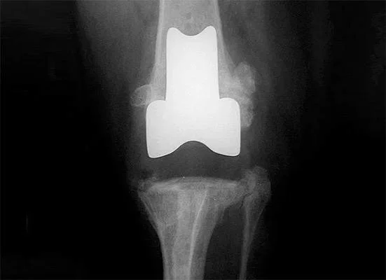 CT scan used in veterinary orthopedic surgery to plan a Canine & Feline Total Knee Replacement.