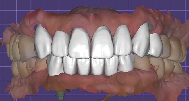 엑소캐드 디자인 완료