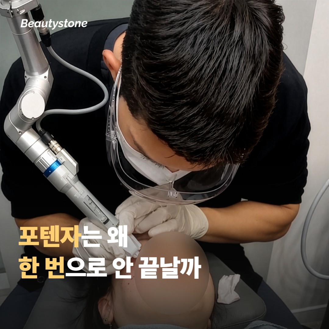 포텐자, 왜 한 번으로 끝나지 않을까요?