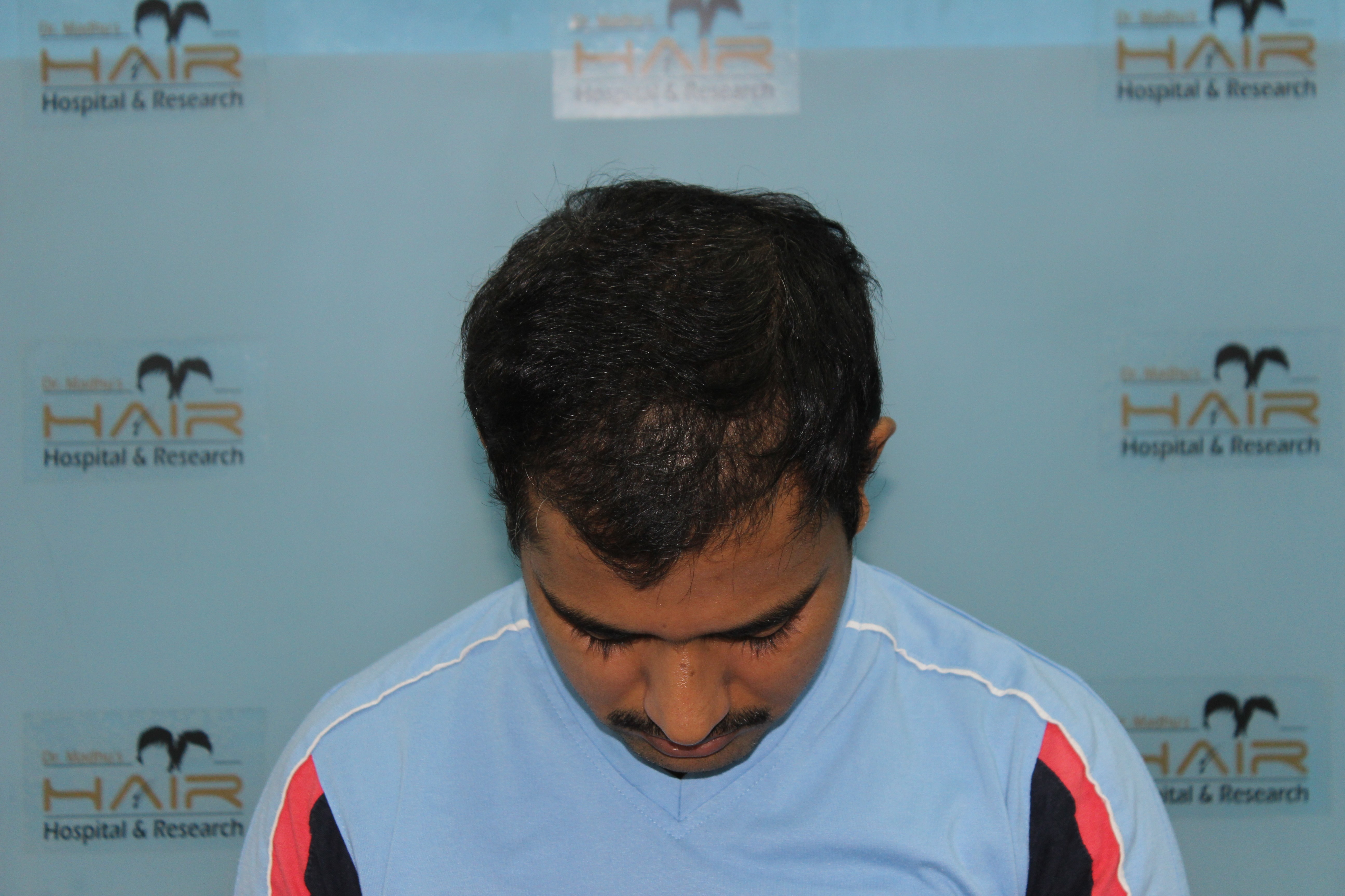 girl smiling while lying on grass field at daytime