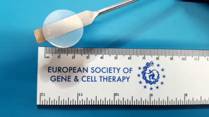 A stemcell which is holden over a ruler to show the size of it. The words: European Society of Gene and Cell Therapy are written on the ruler which lays on a cyan cloth.