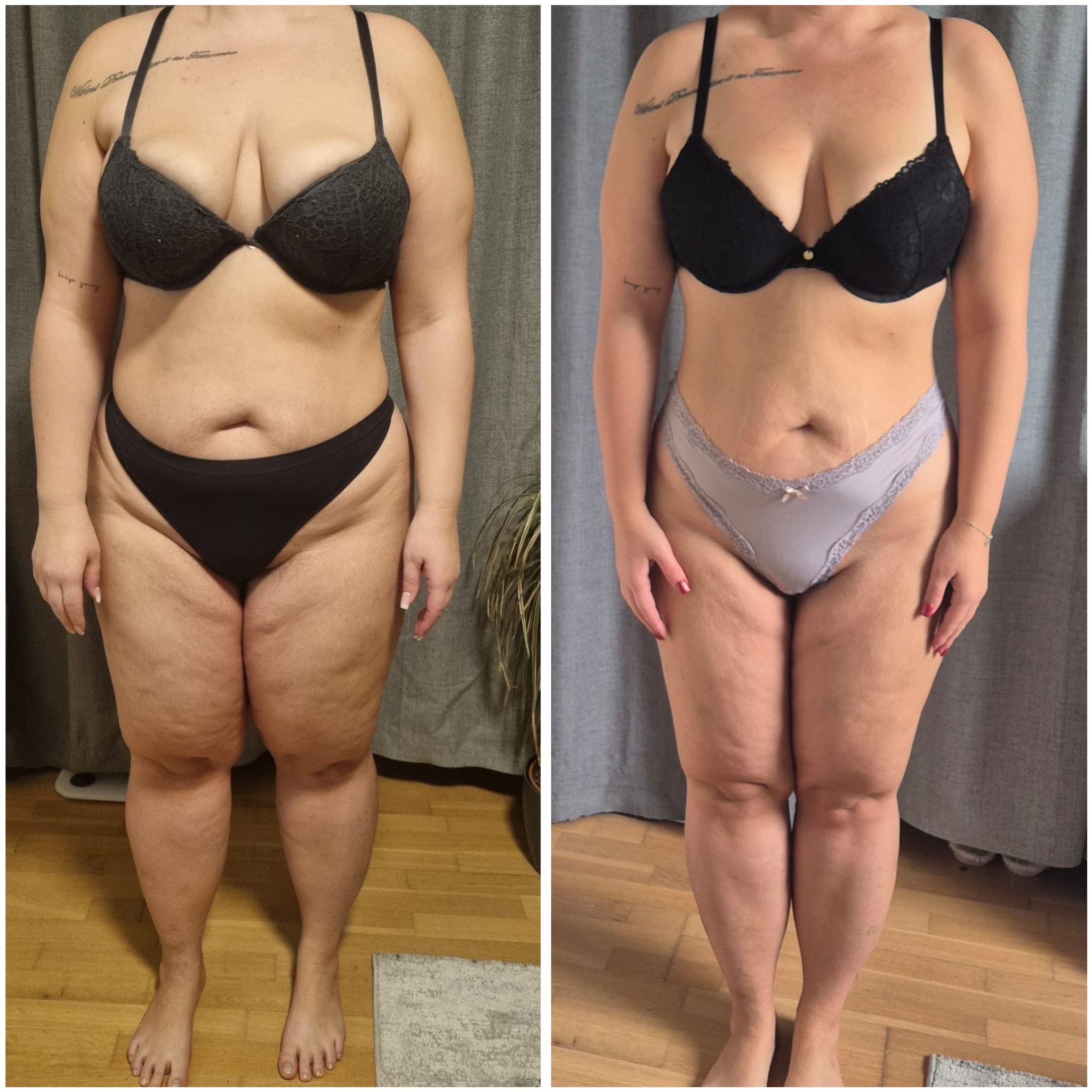 Transformation Photo