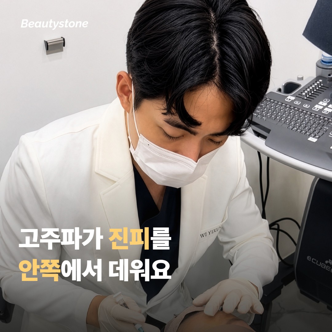 올리지오엑스는 이마에 어떻게 작용하나요