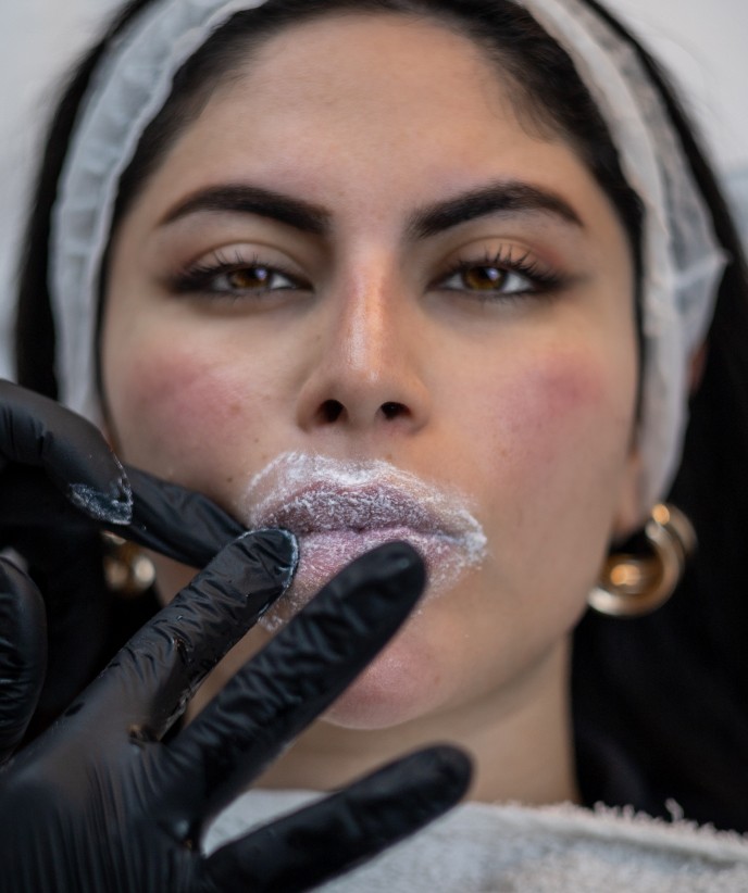 Best lip fillers in Abu Dhabi for natural enhancement. 