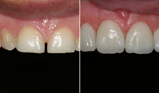 dentes bonitos