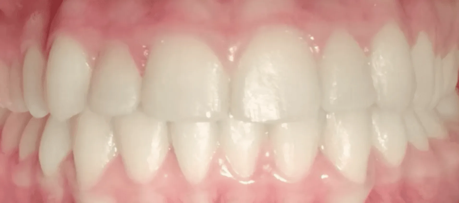 Case 1 — after