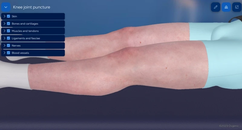 Knee joint injection