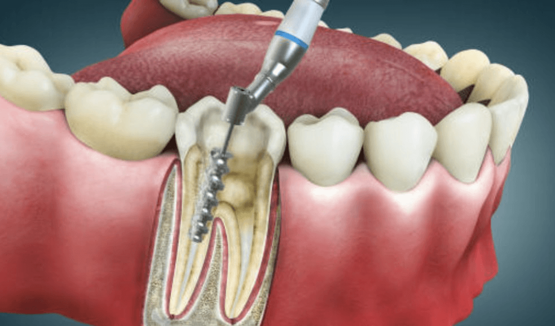 Feature Image