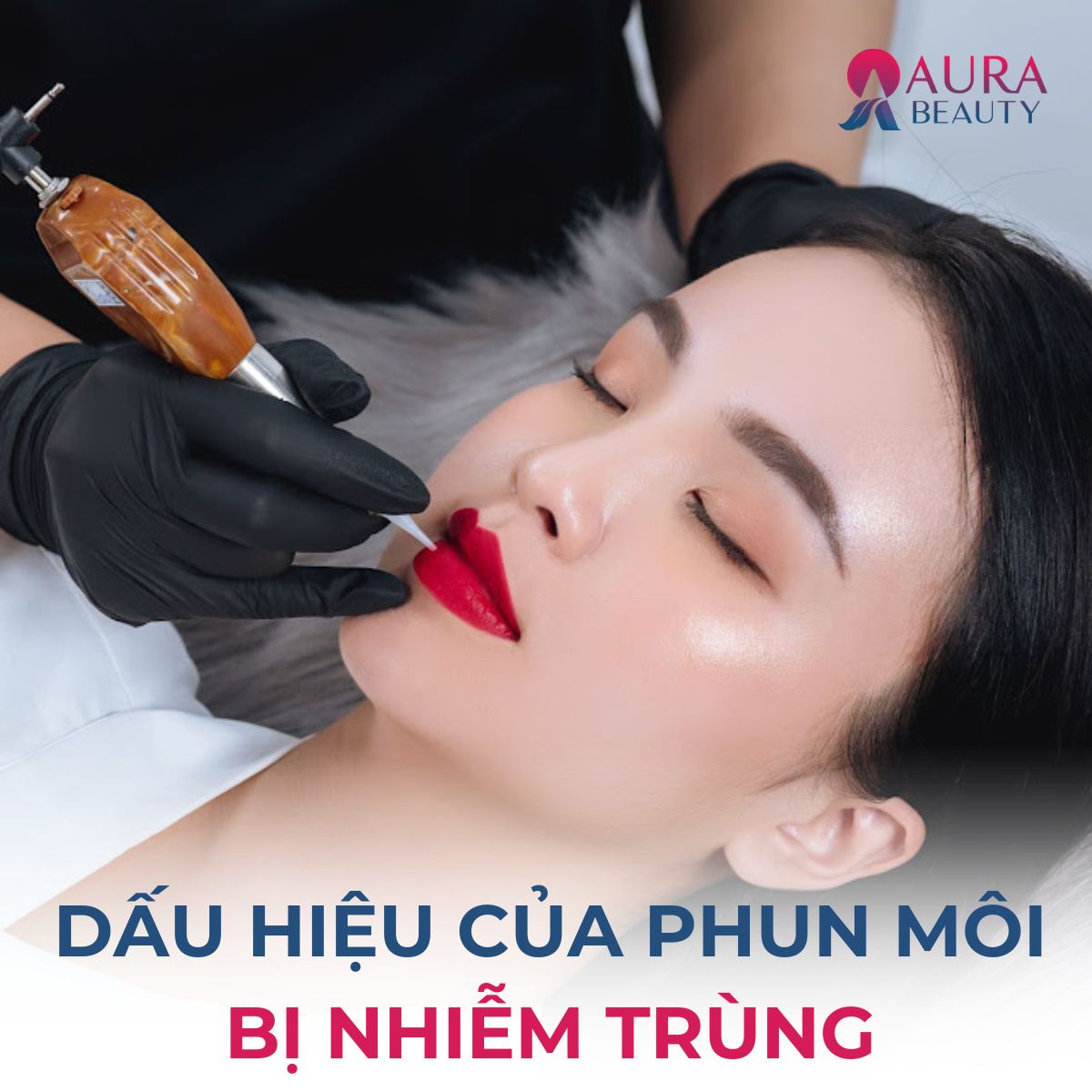 Dấu hiệu phun môi bị nhiễm trùng