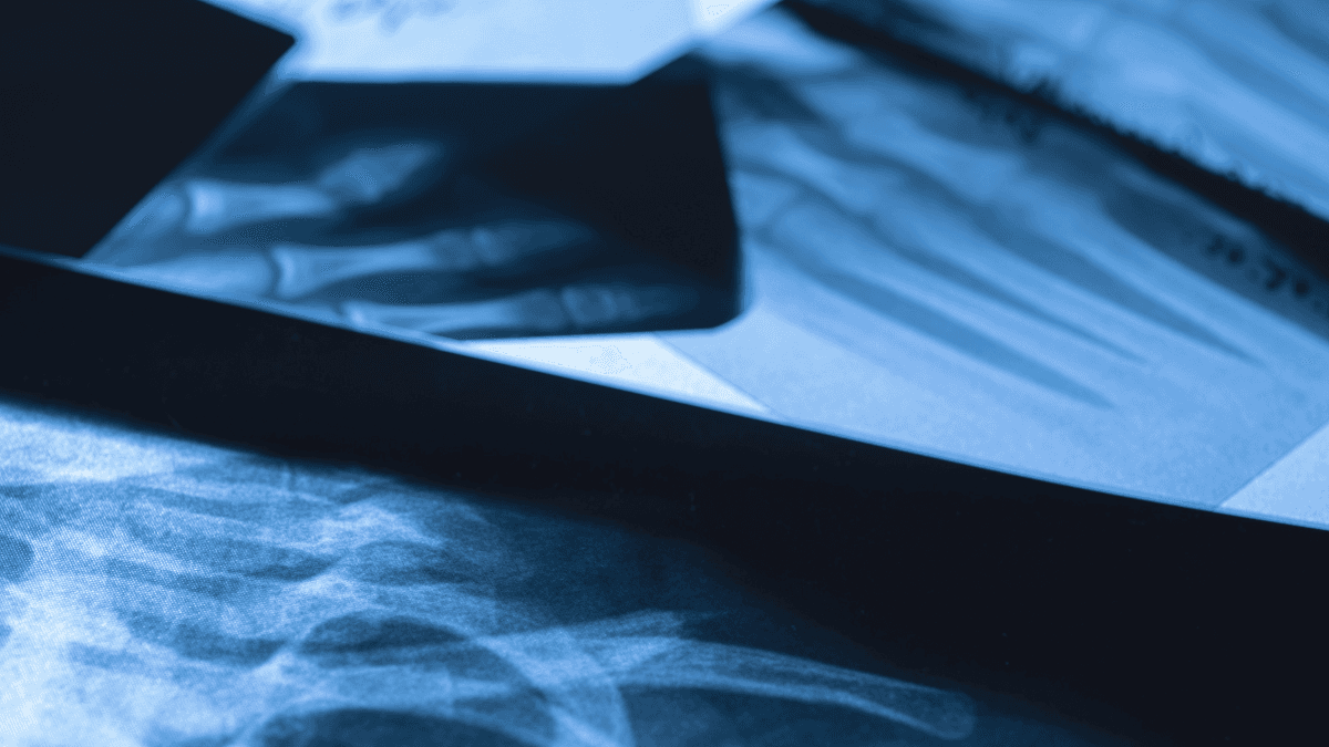 AI Copilot for Doctors