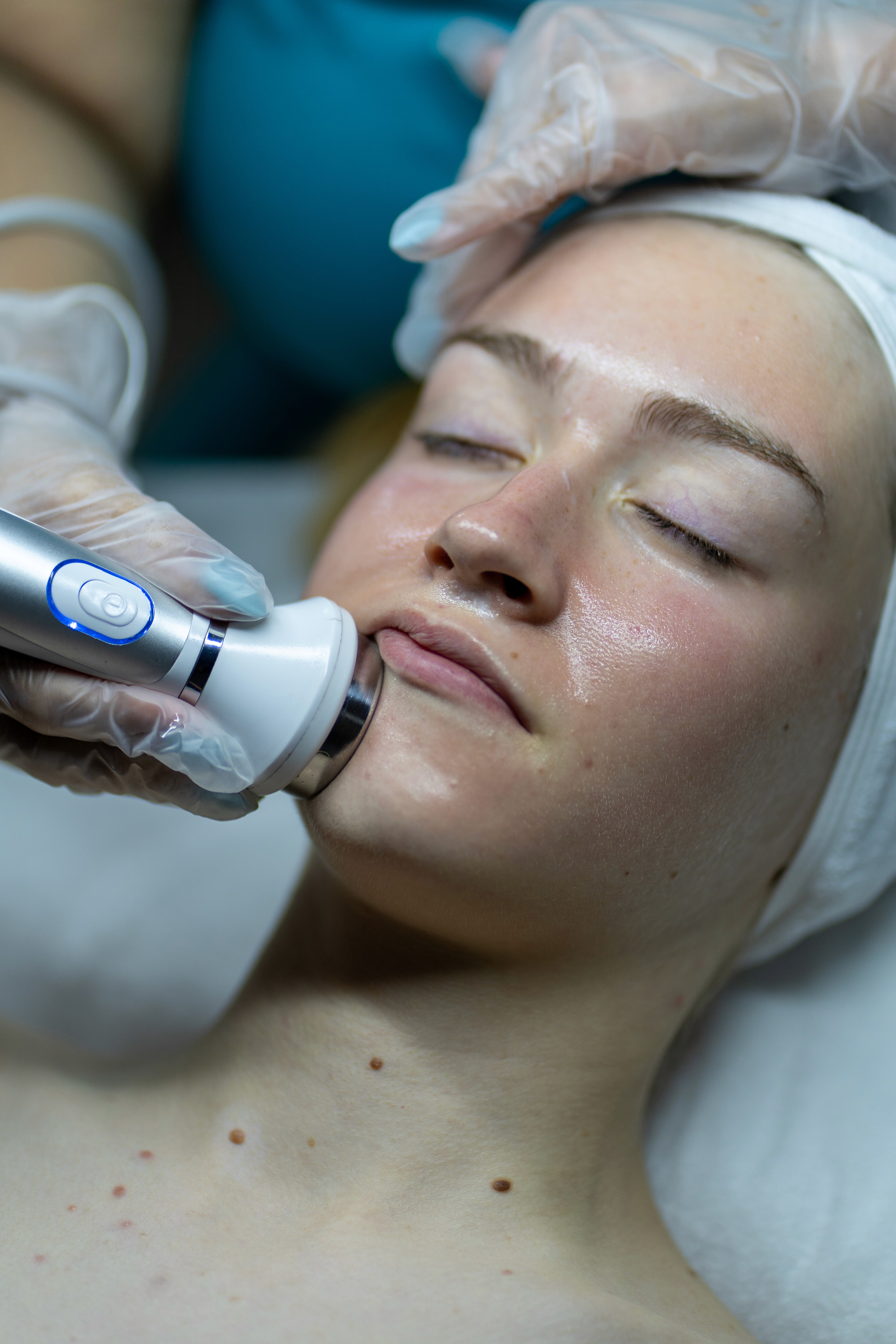 woman lying on blue towel with white cream on face