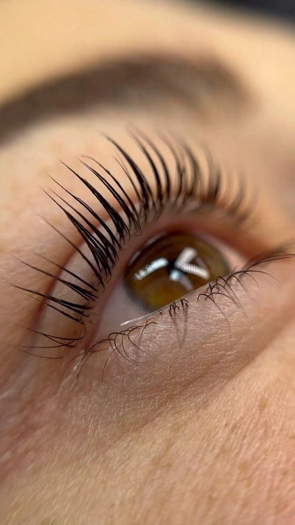 Crop view of an eye, after the procedure