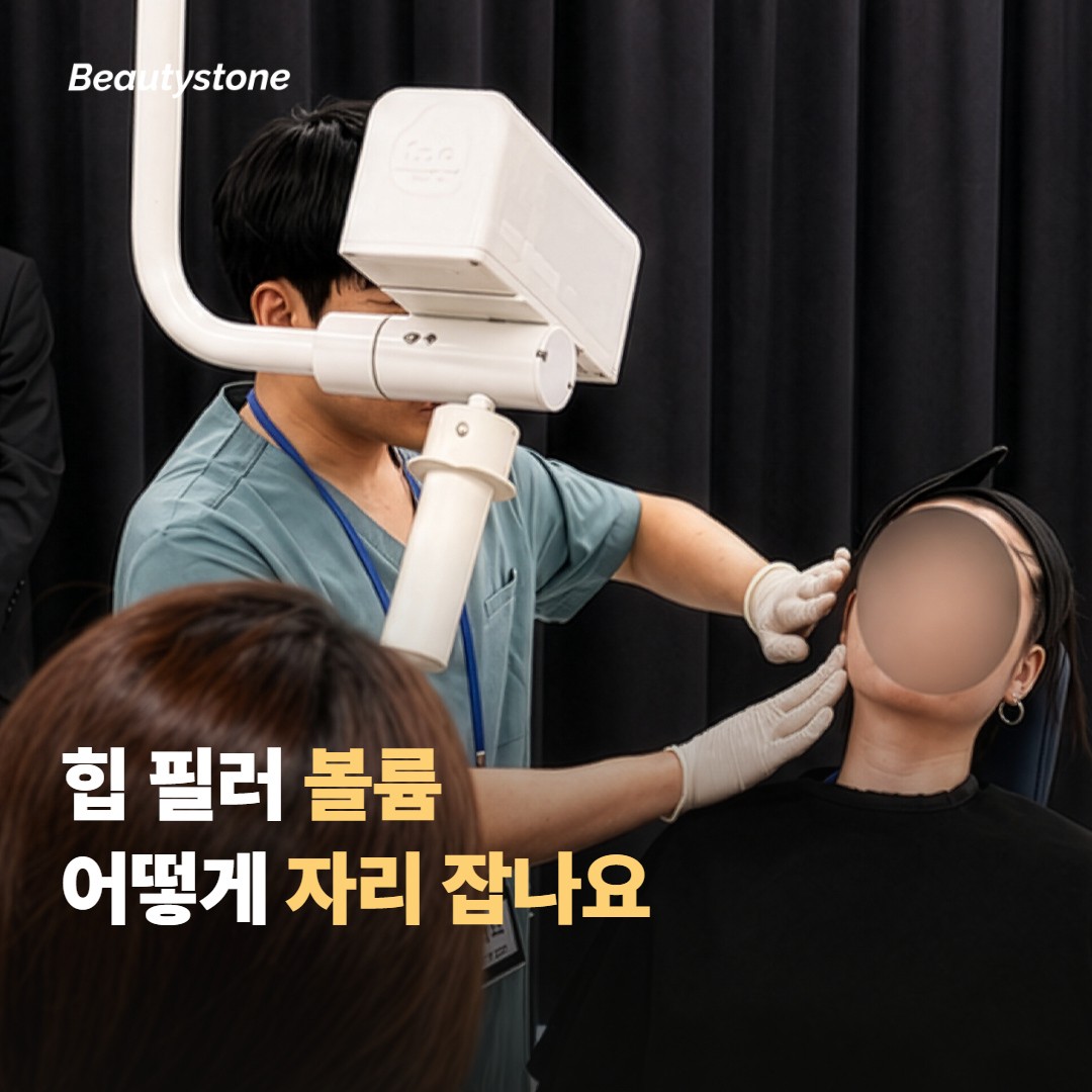 힙 필러 볼륨은 어떻게 자리 잡나요