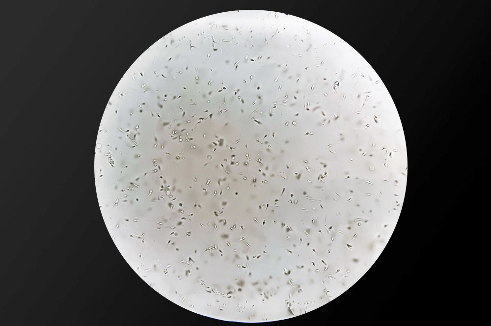 specimen under microscope