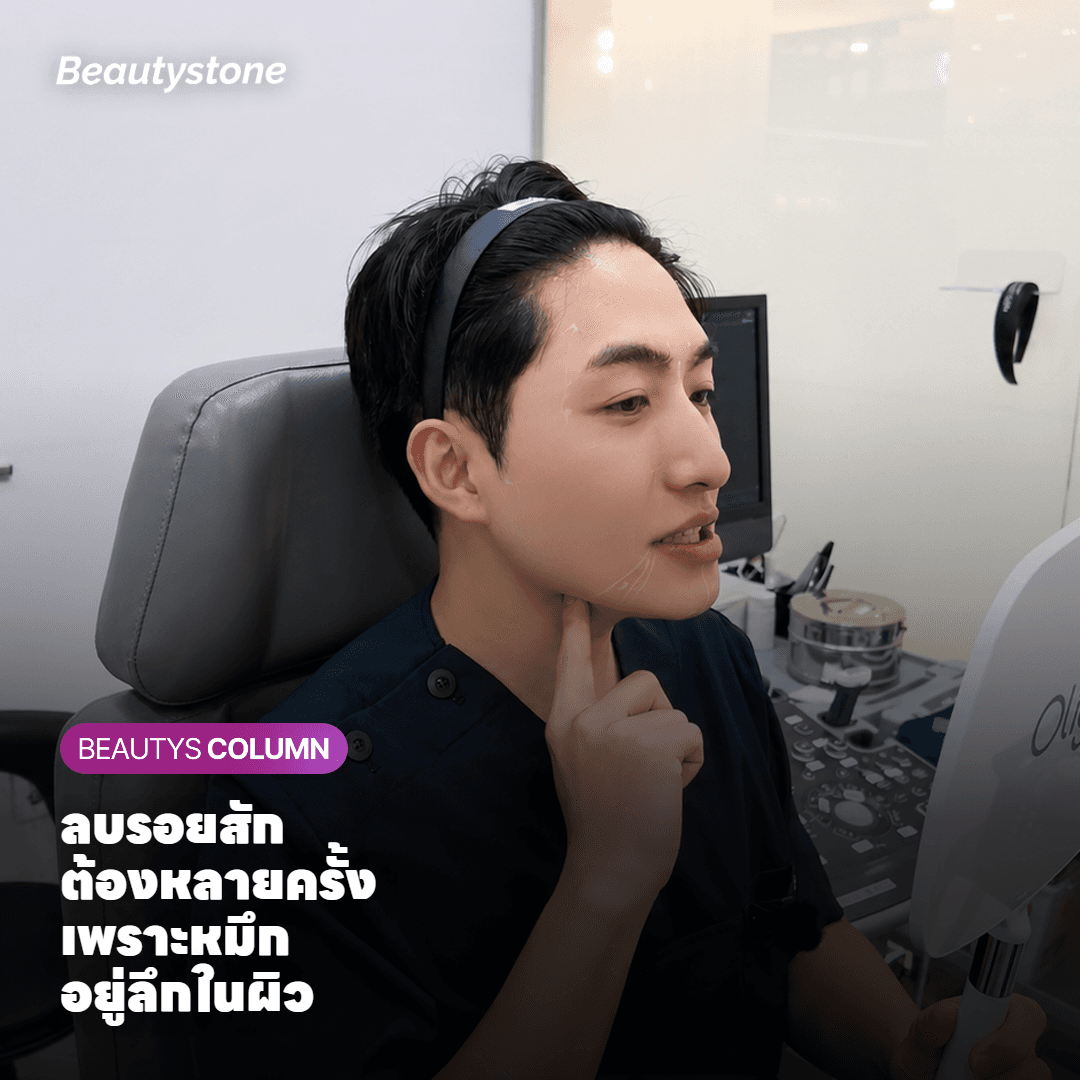 ครั้งที่ยังไม่ได้ใช้ โอนไปทำส่วนอื่นได้ไหม?