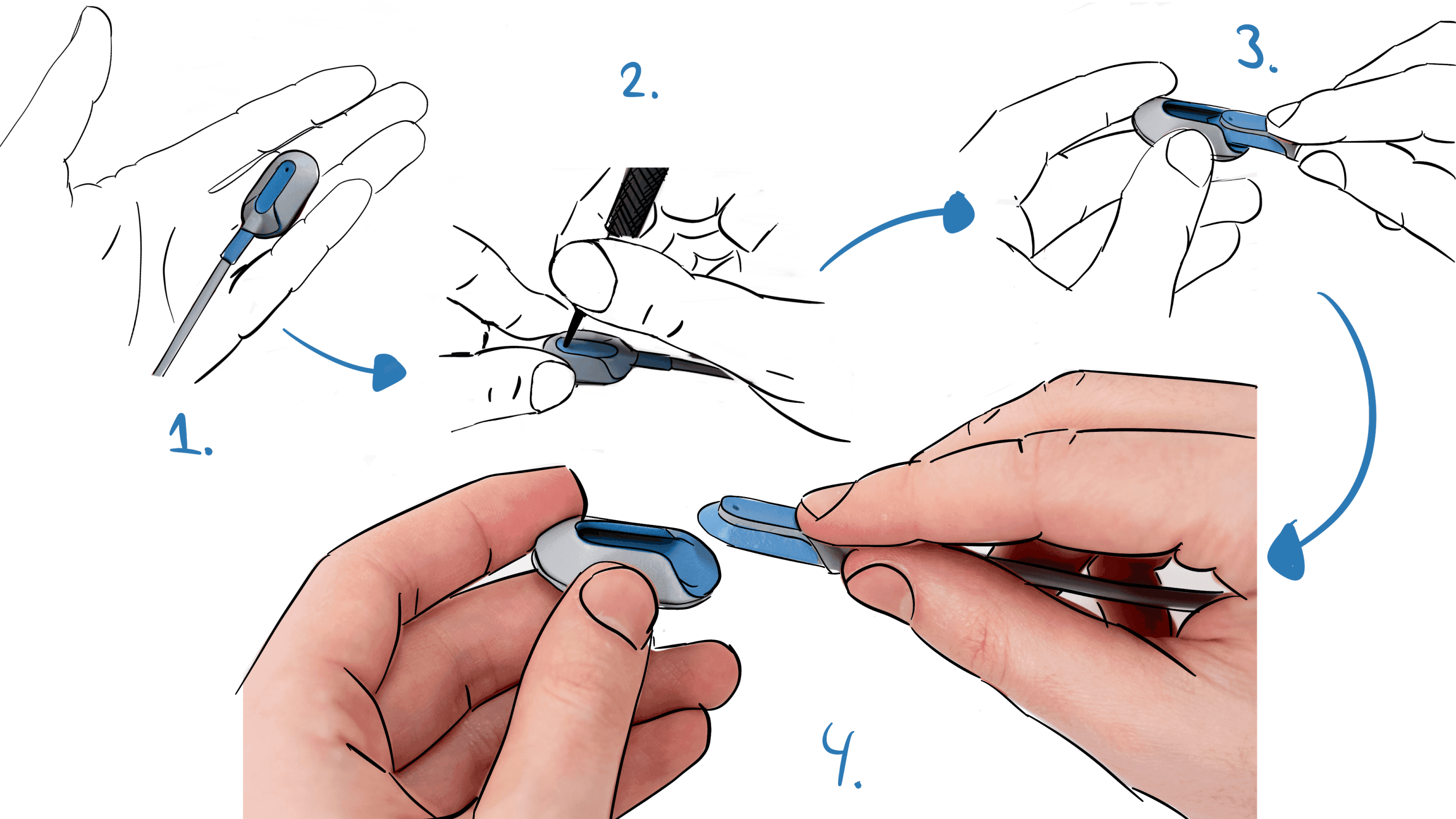 Application and disassembly sequence