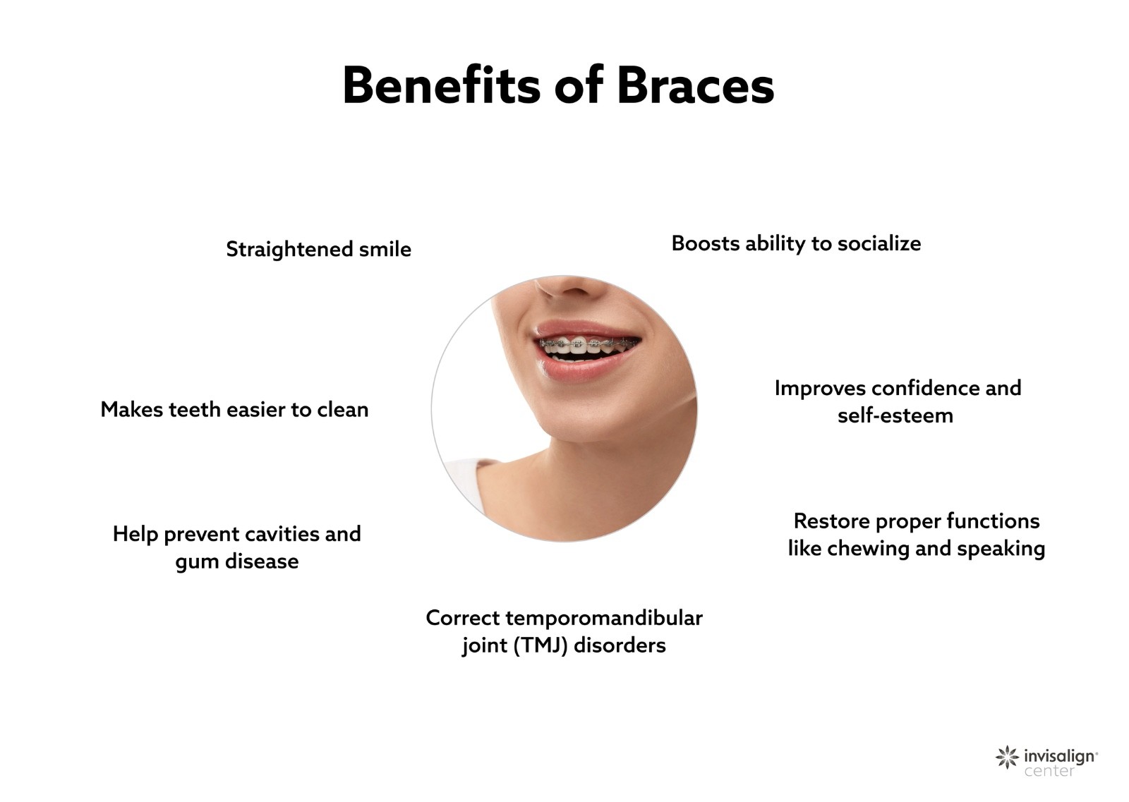 Benefits of Braces