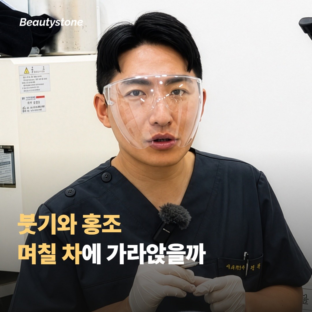 며칠 차에 가라앉을까요, 붓기와 홍조 회복 흐름