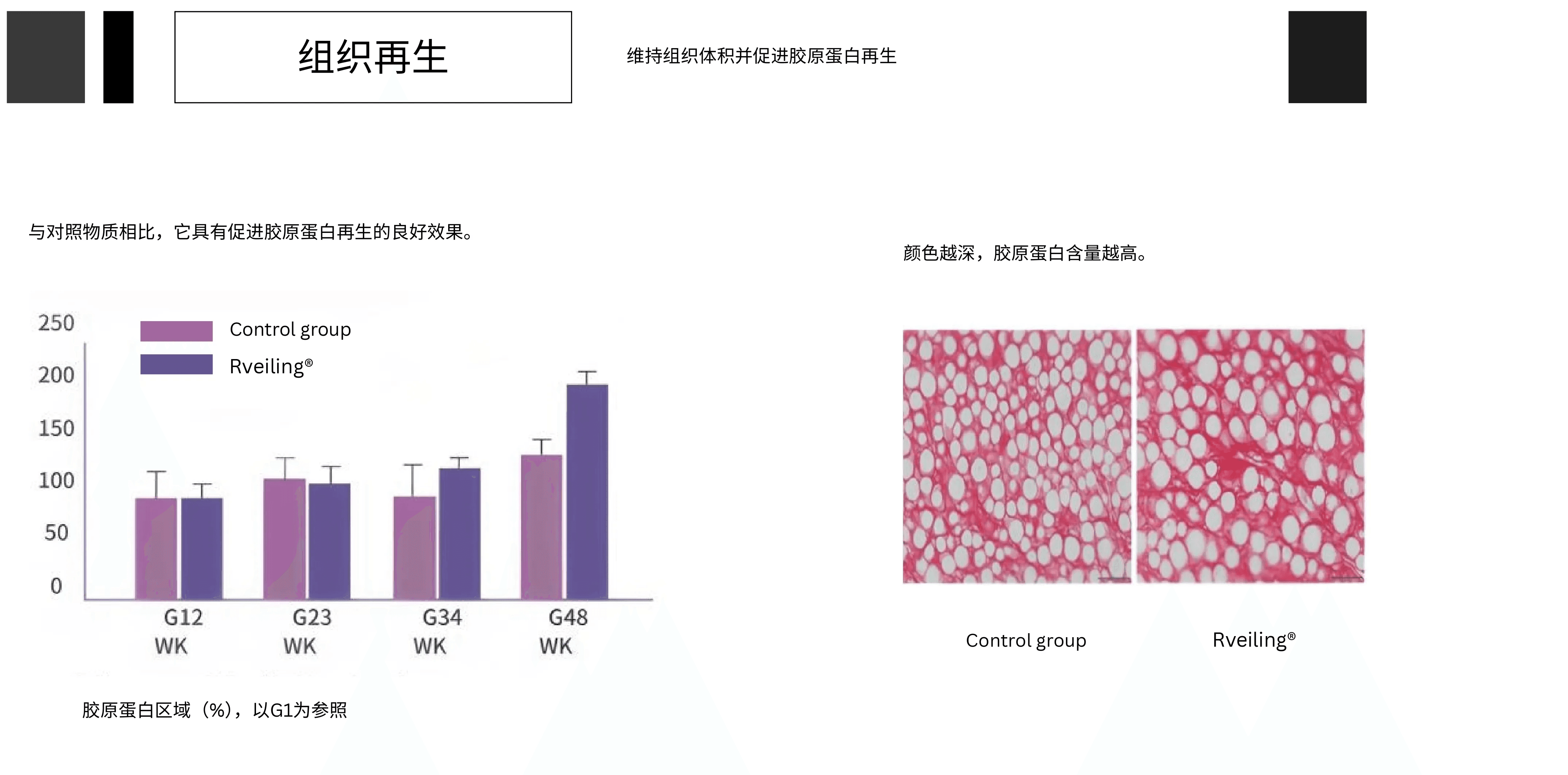 Aowita manufactory Advances in Poly-l-lactic Acid Injections for Facial chinese