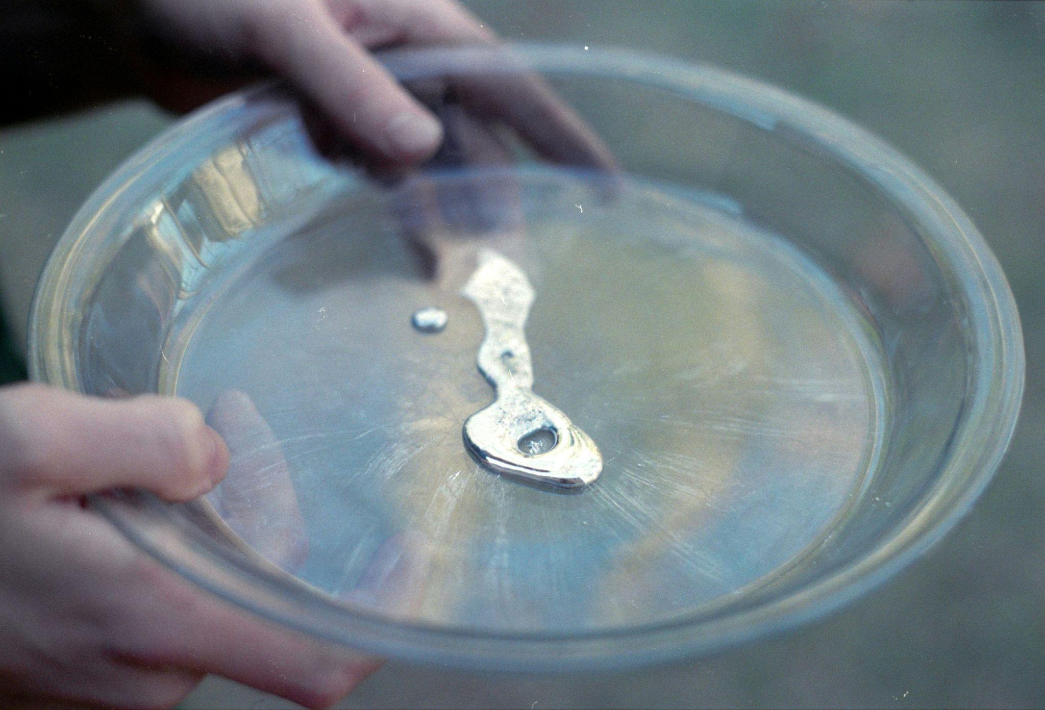 Mercury Poisoning: Symptoms, Causes, and How to Check For Heavy Metal Exposure