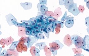 A blue and pink cells
Description automatically generated
