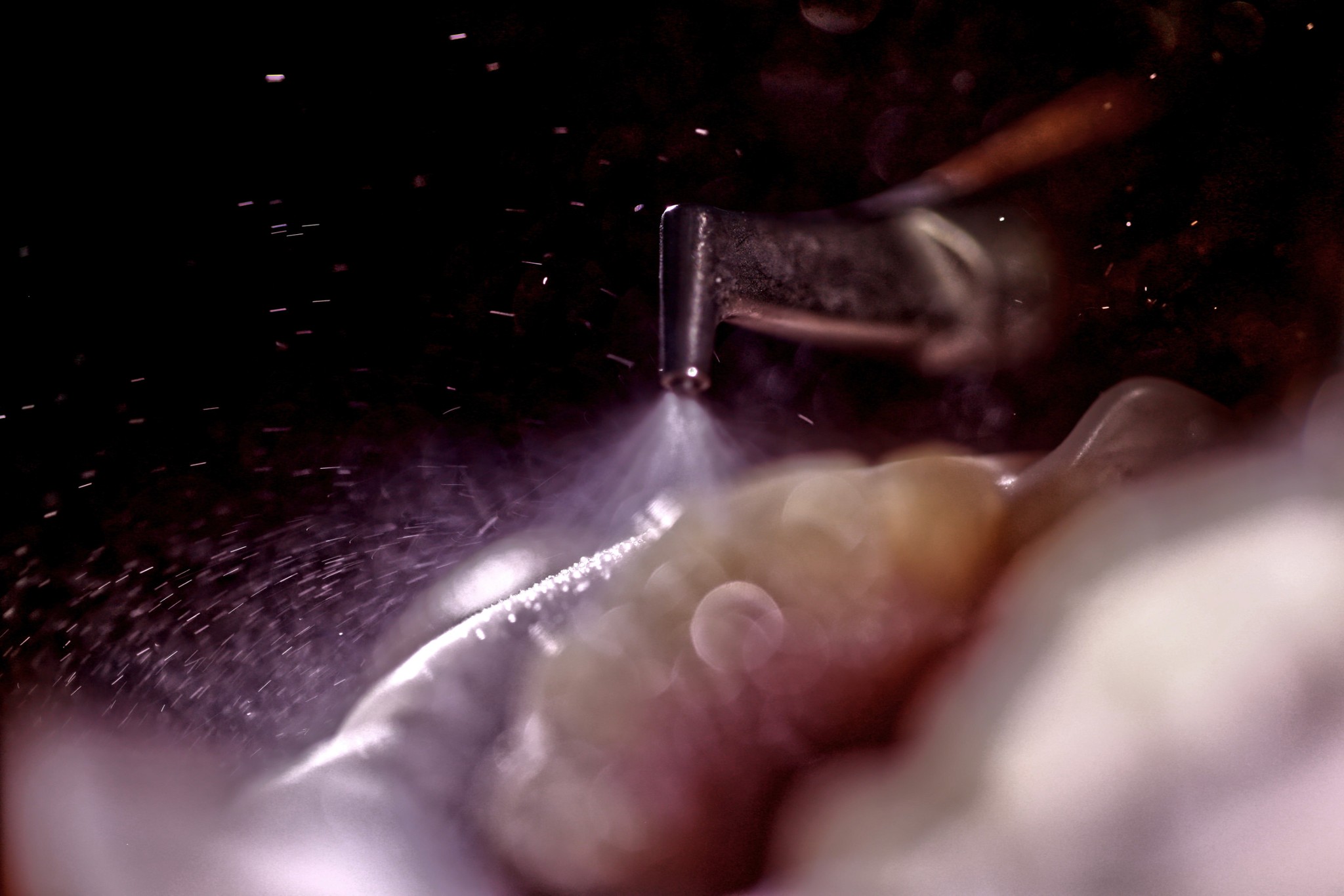 pieskovanie počas návštevy dentálnej hygieny