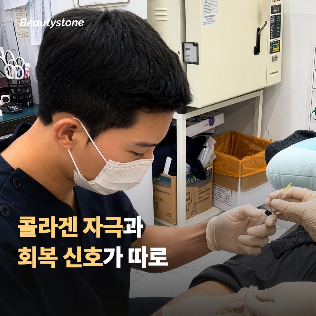 지속 기간이 다르게 보이는 이유