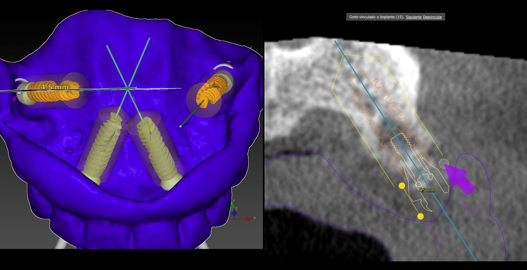 Fórmate en la Técnica de Doble Factor 