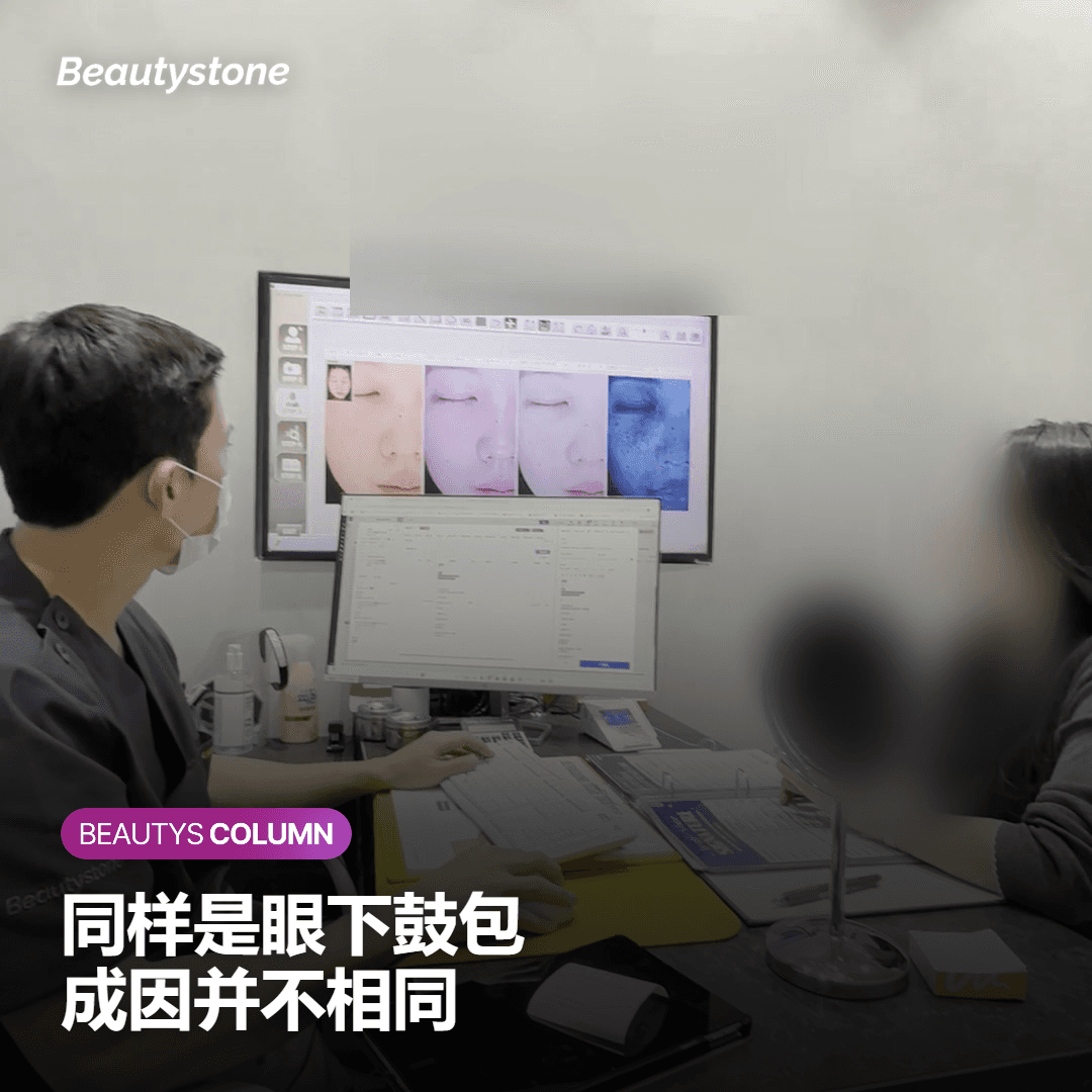 眼下鼓包：先分清是松弛还是脂肪