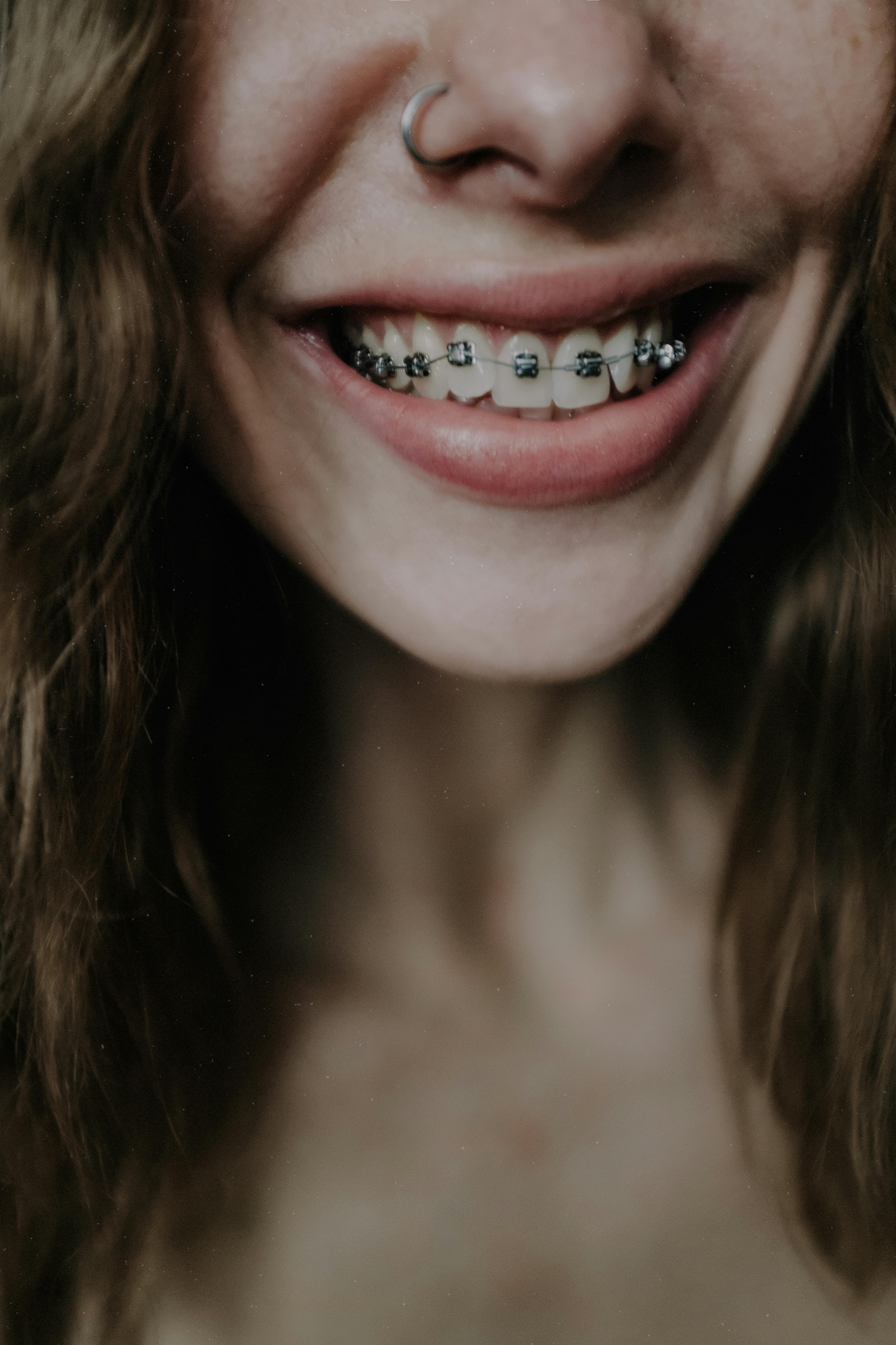 Comprehensive Orthodontic Treatments