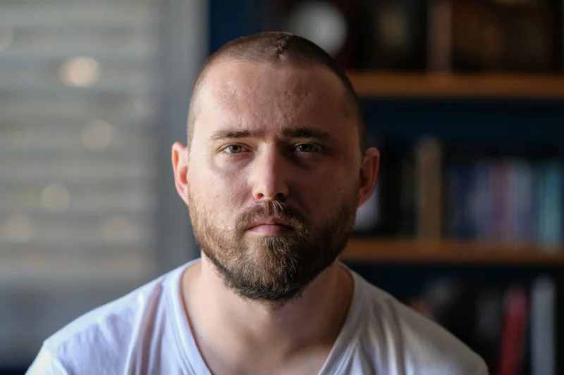 man staring at camera for photo who has had a brain injury