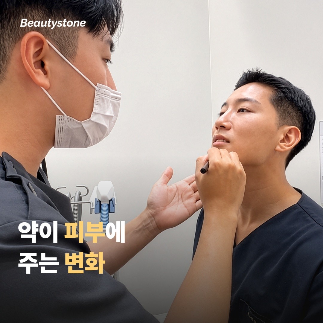 이소트레티노인은 피부에 어떤 변화를 줄까요