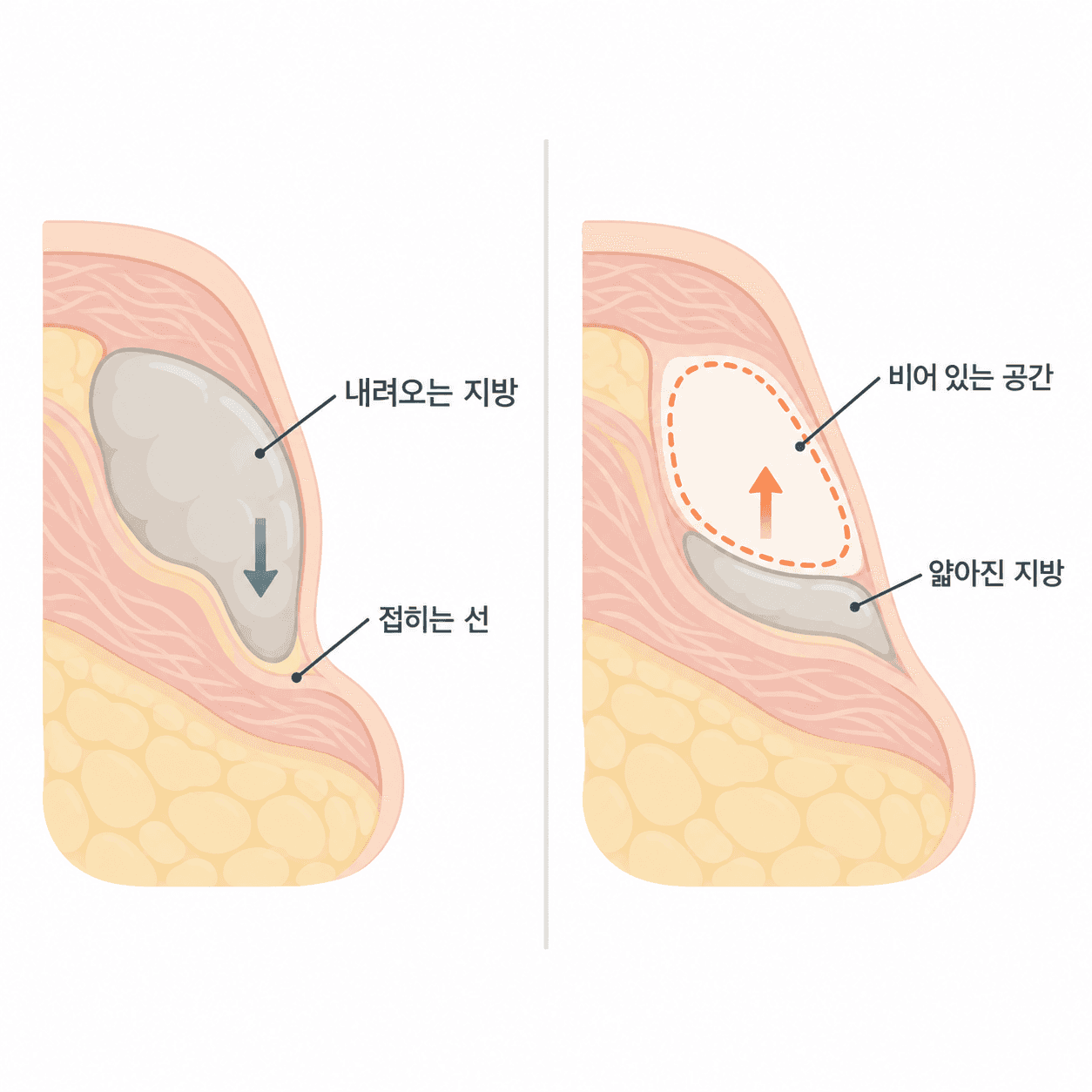 내려오는 쪽과 비어 있는 쪽은 서로 다른 변화예요.