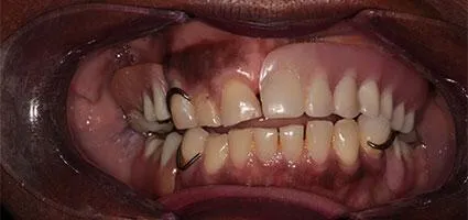 Before Image