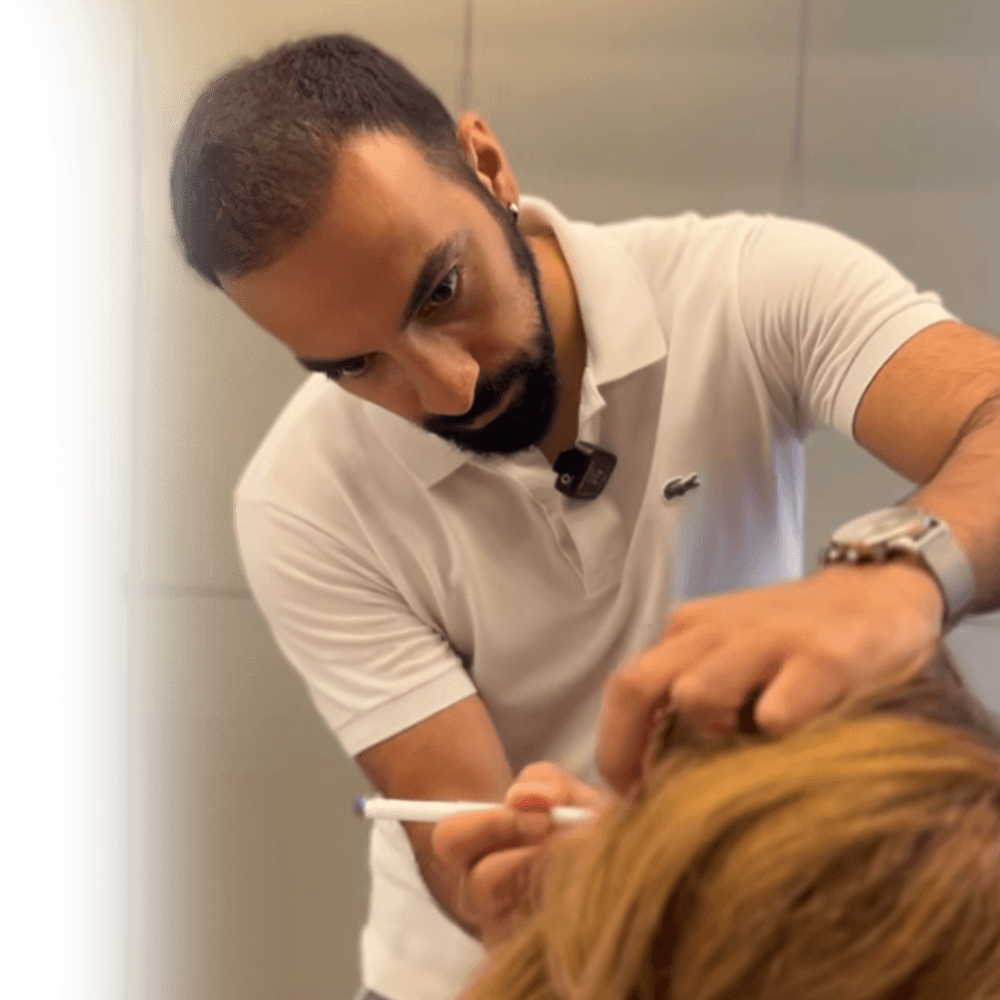 blefaroplasti için ameliyat öncesi çizim