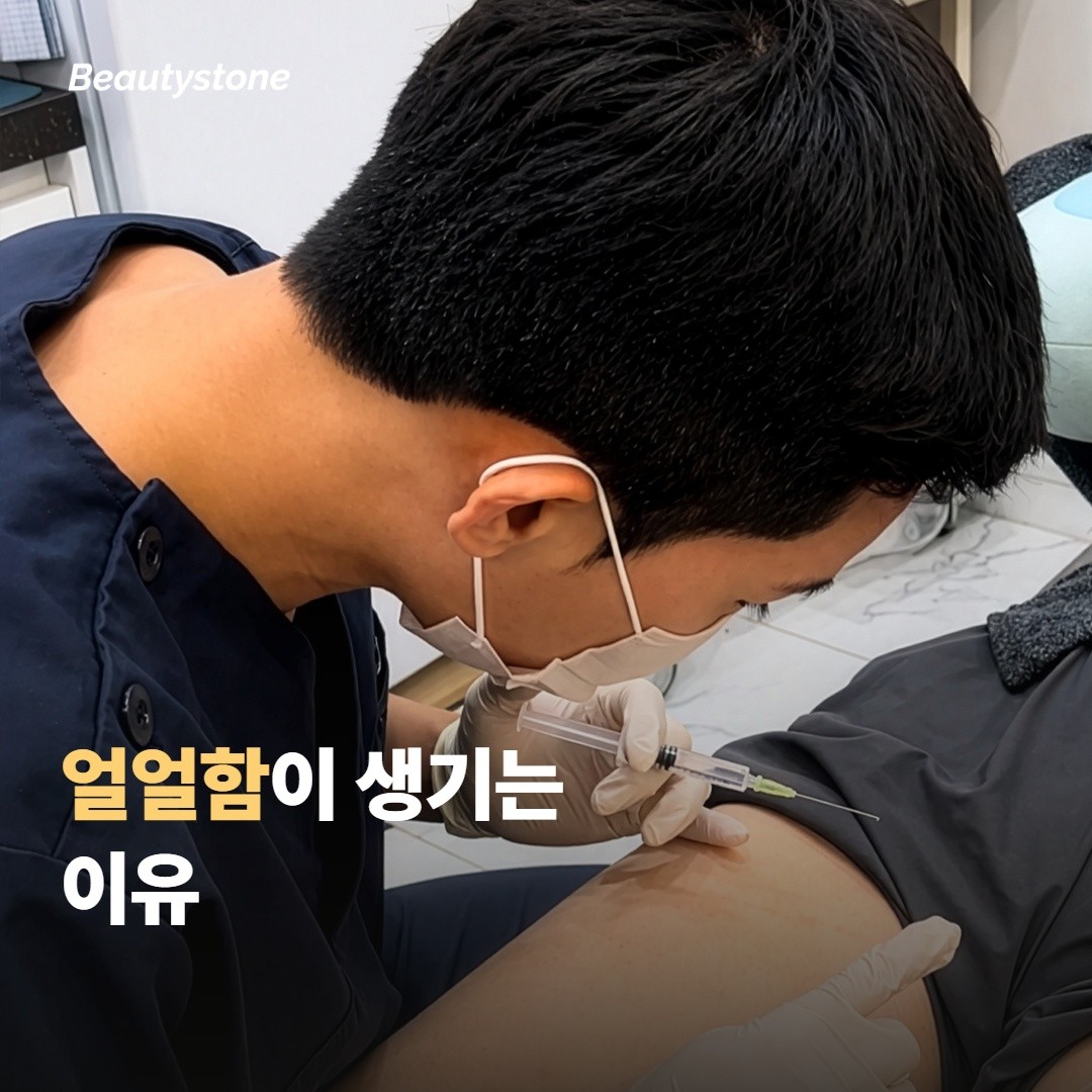 써마지 받고 얼얼함이 생기는 이유