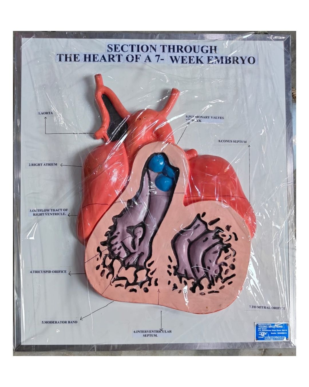 Section Through the Heart of a 7-Week Embryo