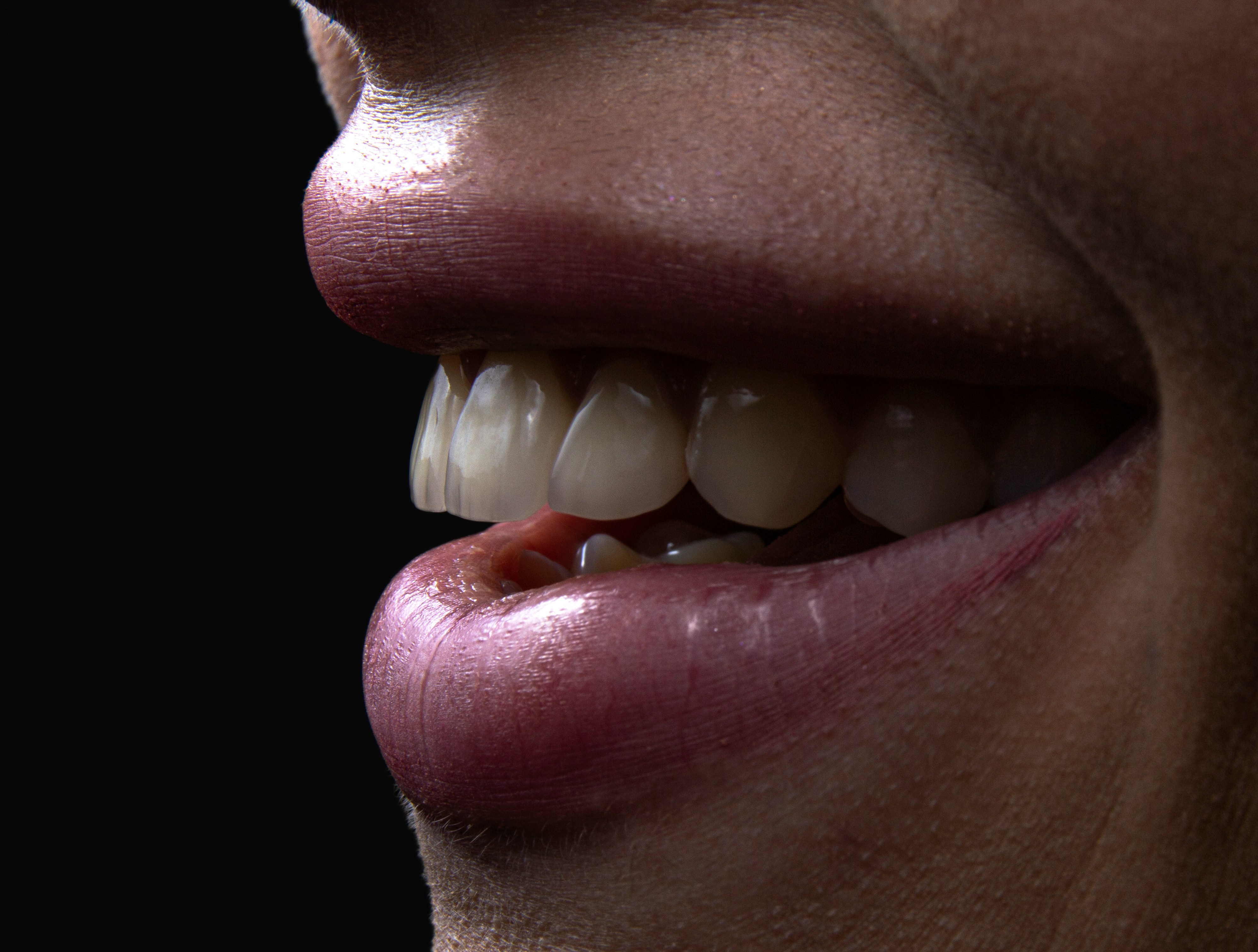 Dental Implants in Rochelle Park, NJ