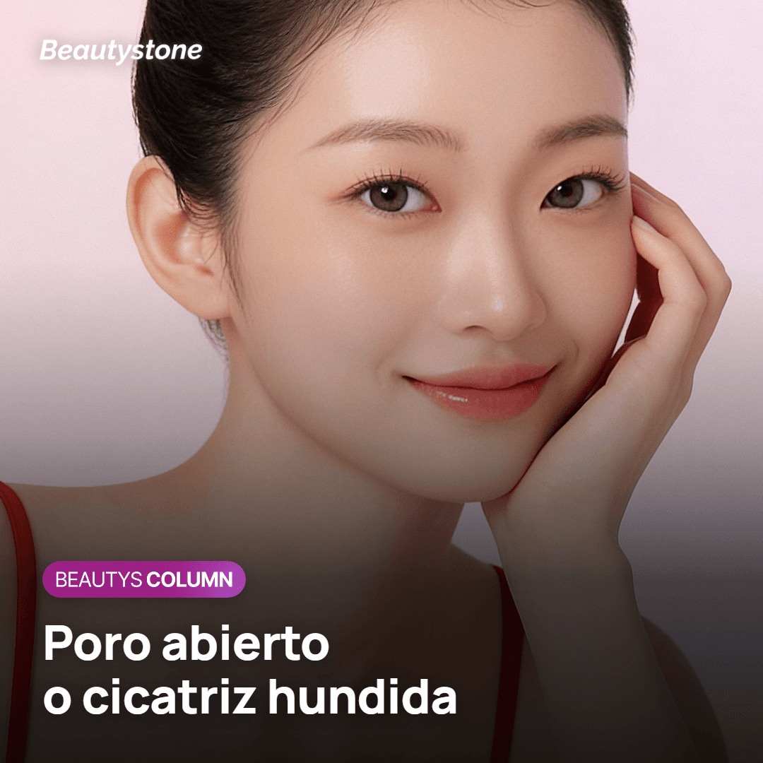 Diferencia entre poro dilatado y cicatriz de acné con forma de poro