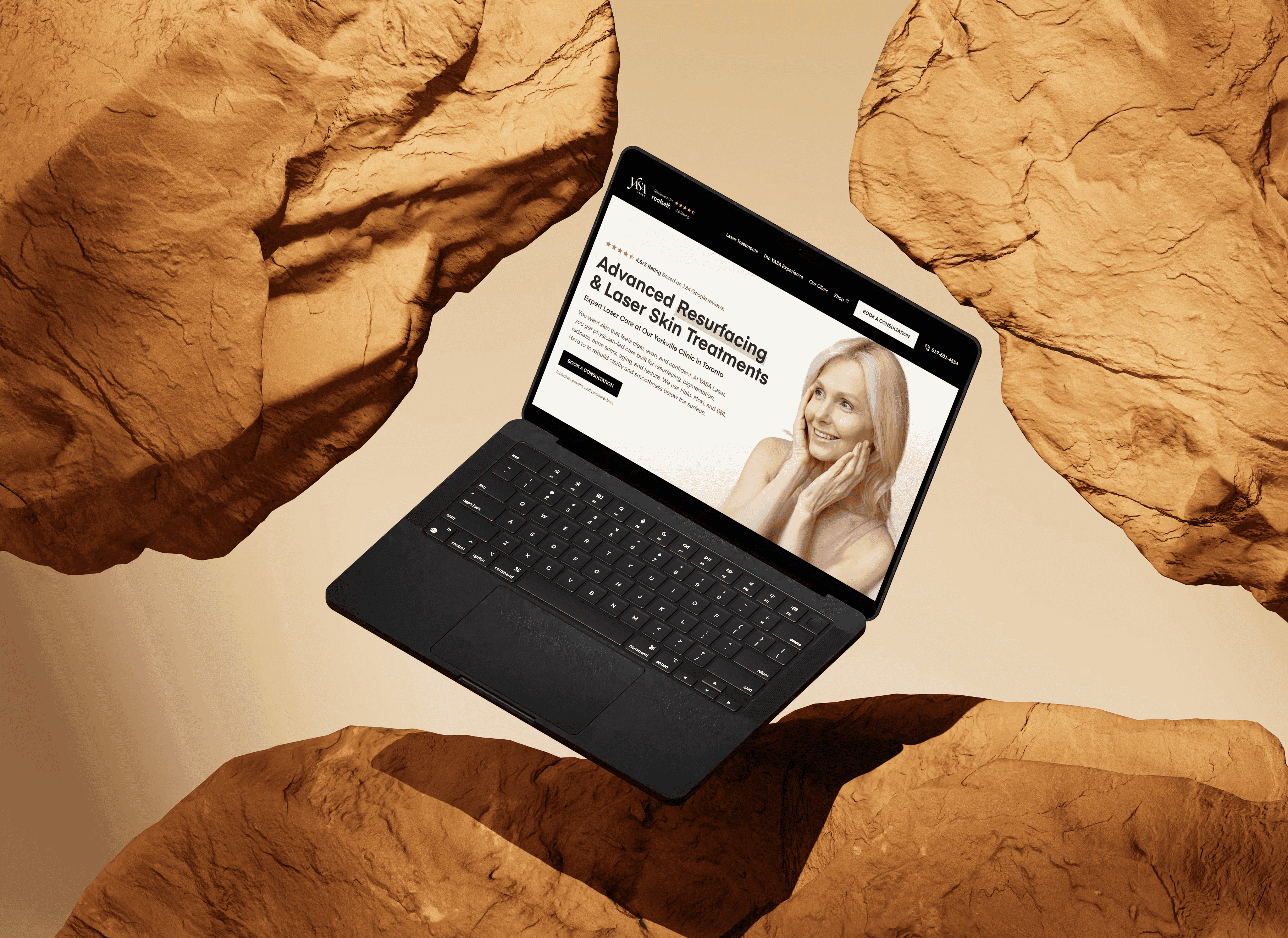 A black laptop is suspended between large sandstone rocks, displaying a website for advanced resurfacing and laser skin treatments. The screen shows a smiling woman next to bold text promoting expert skin care in Toronto, with a call-to-action button to book a consultation.