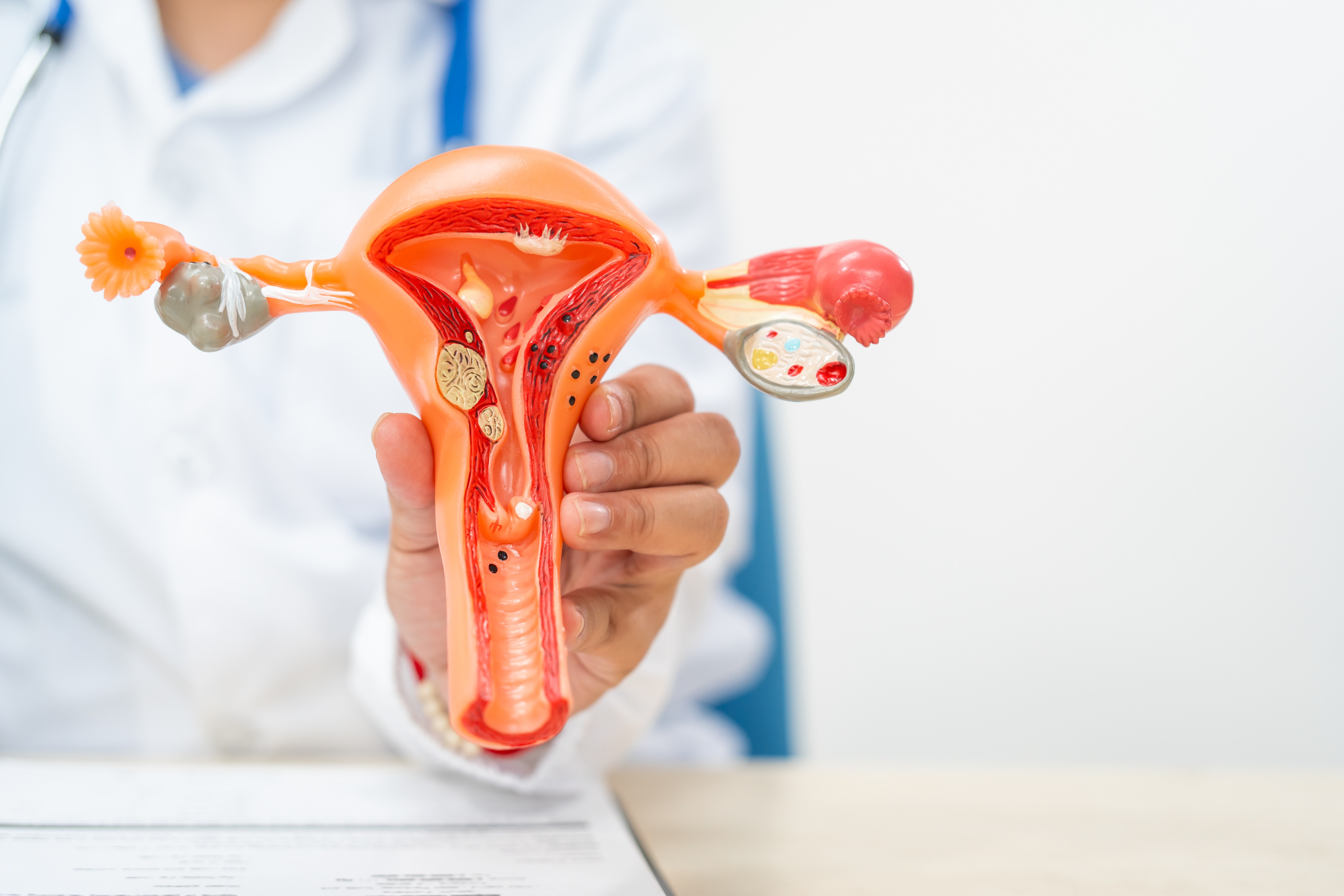 Doctor holding a detailed uterus and ovaries anatomical model