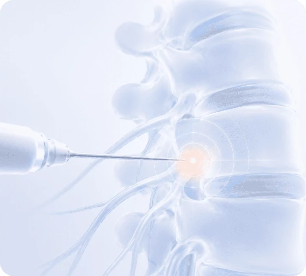 Image-guided pain management