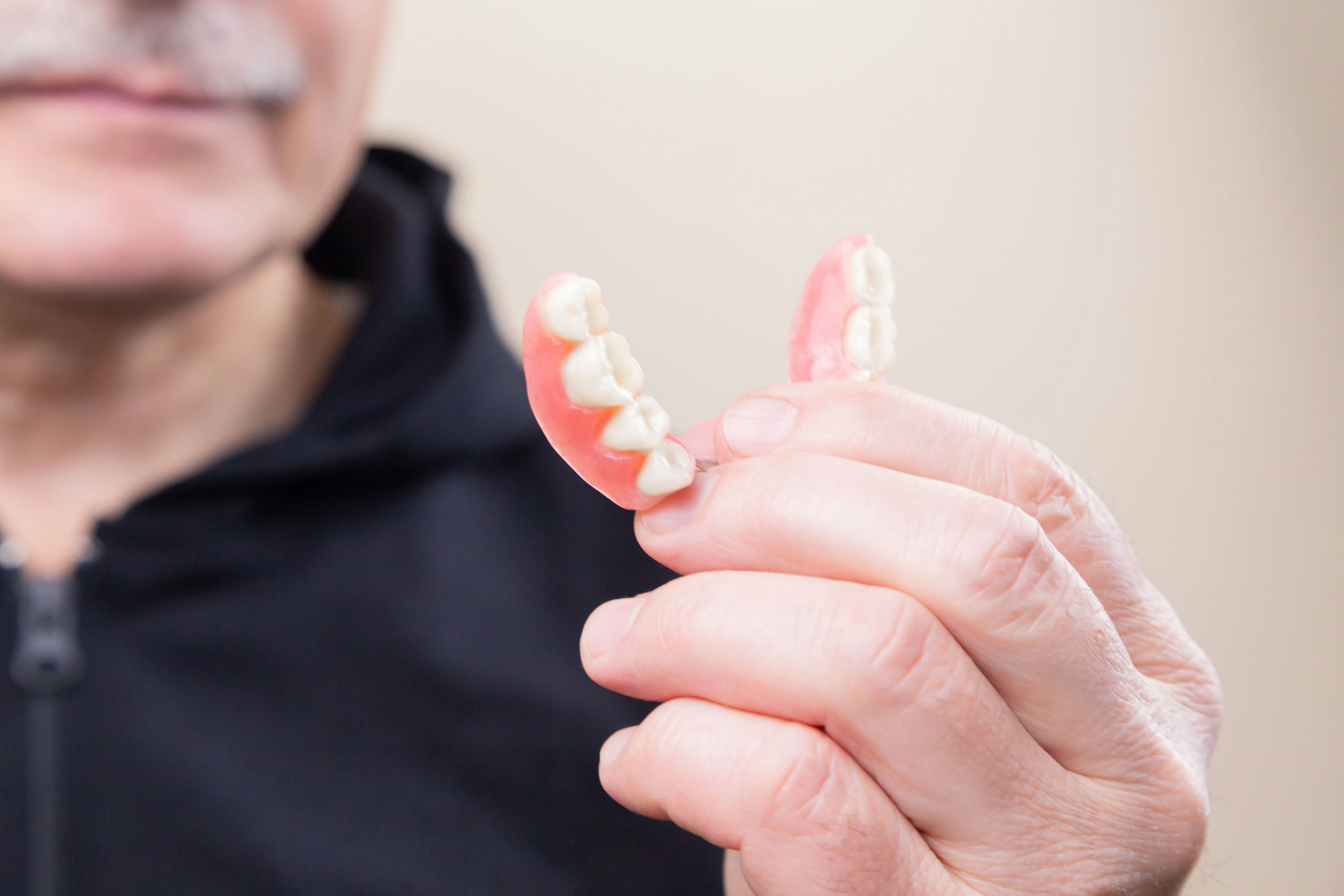 Dentures in North York at Sovrle Dental