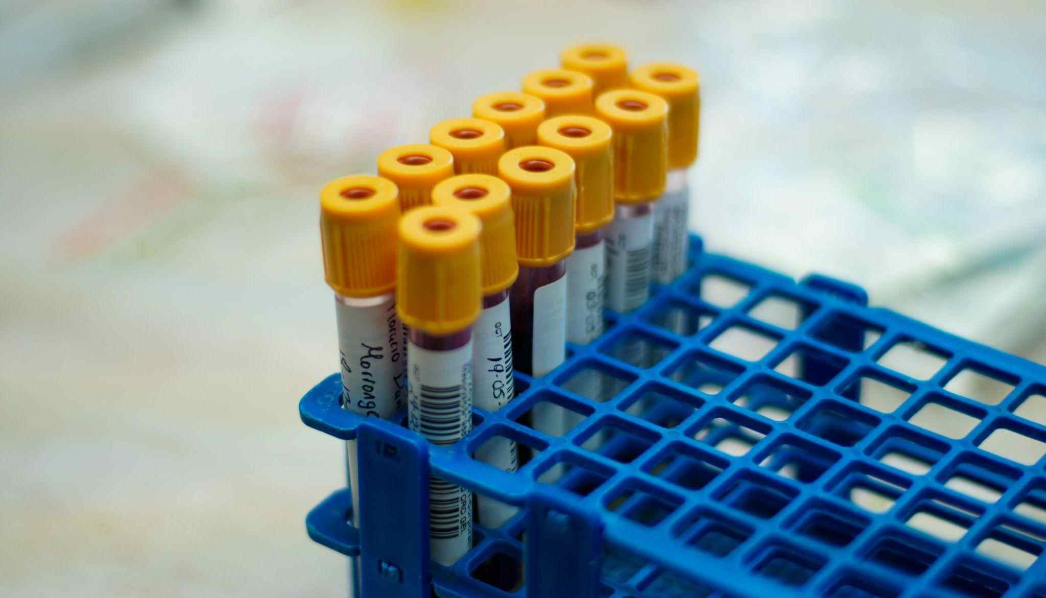Female Hormone Testing: A Guide for Women at Every Stage | Mito Health