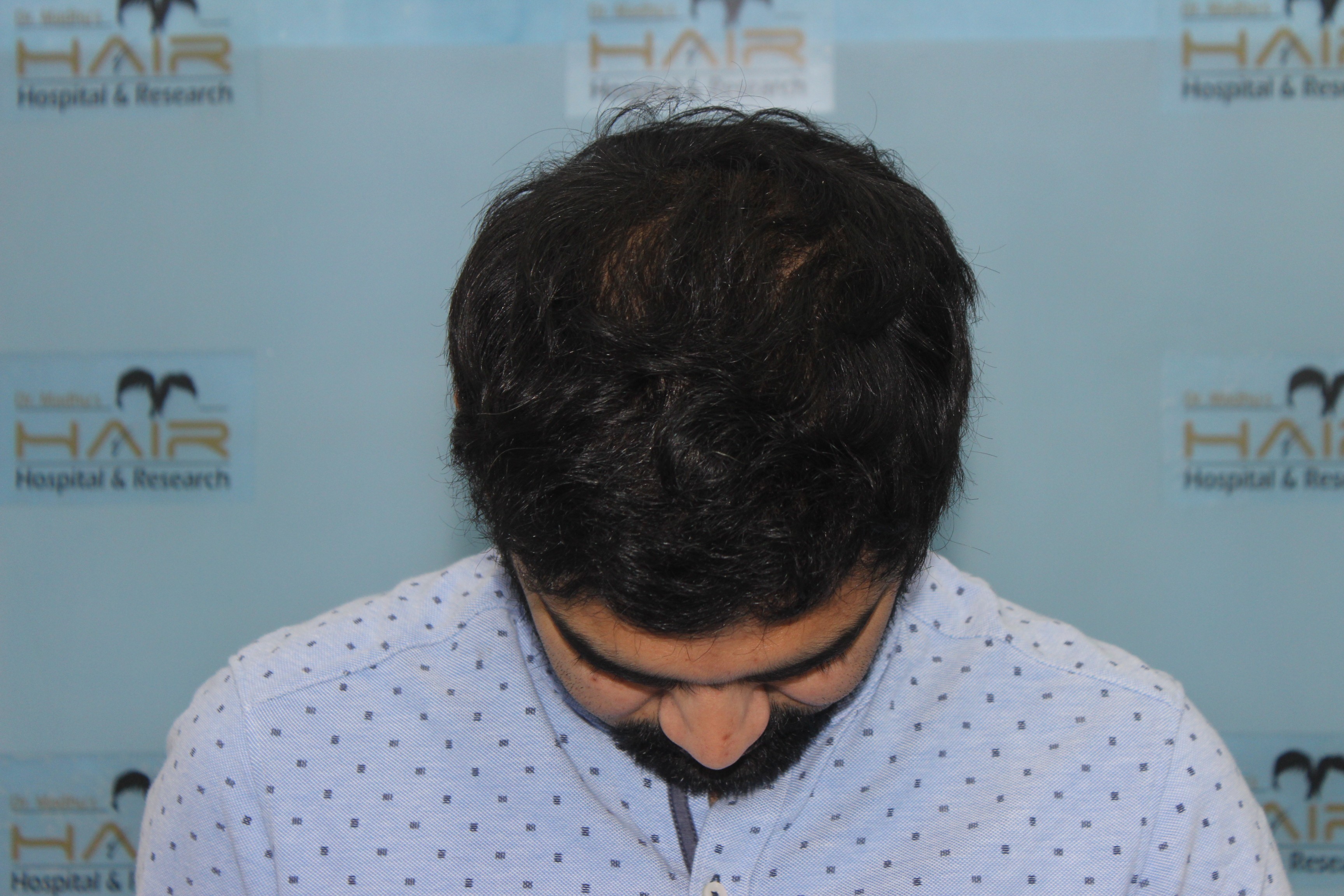 Close-up of smile with clean white teeth